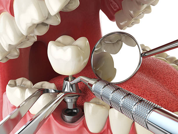Best Pediatric Emergency Dentist in Masury, OH
